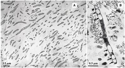 Novel thermophilic genera Geochorda gen. nov. and Carboxydochorda gen. nov. from the deep terrestrial subsurface reveal the ecophysiological diversity in the class Limnochordia